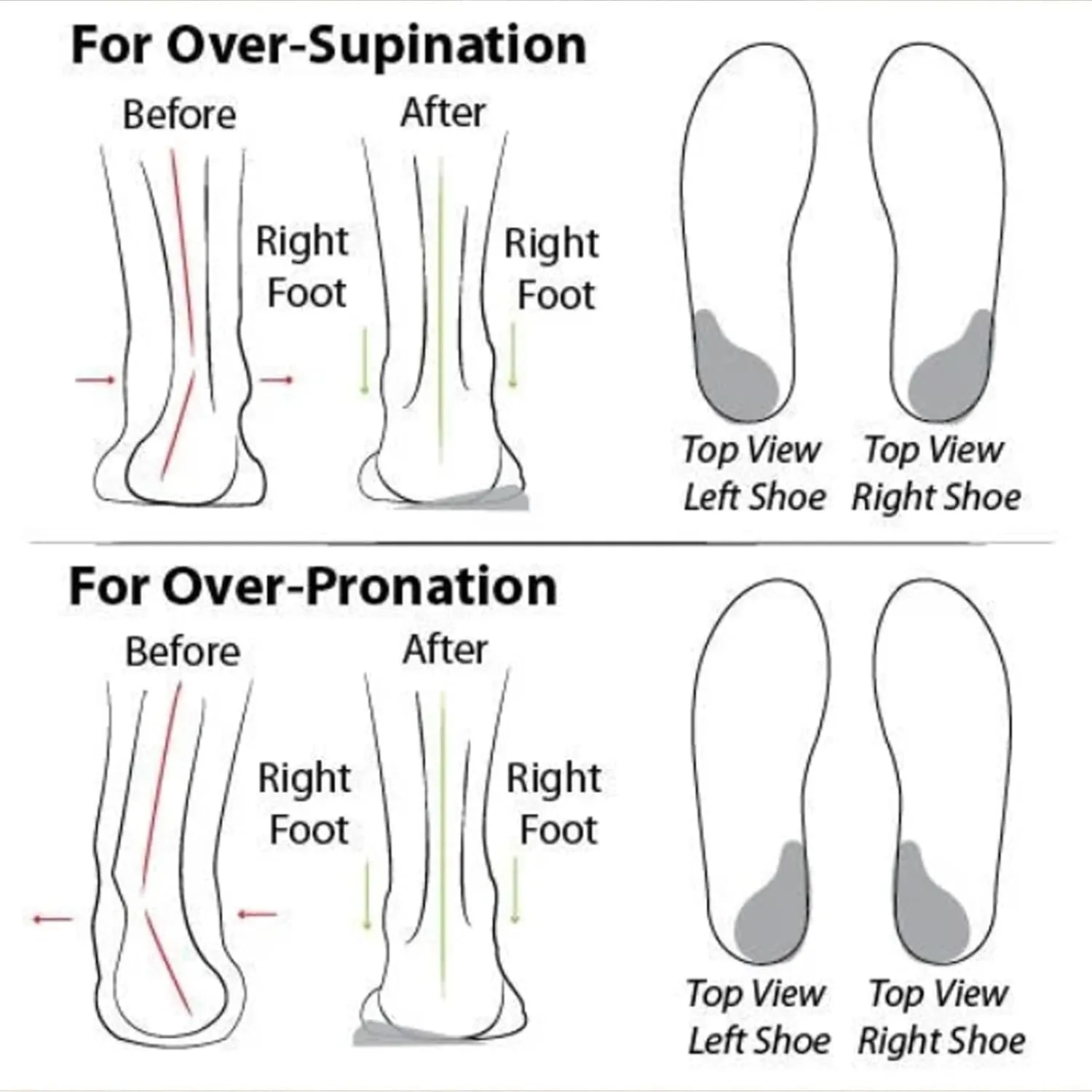 Women's Orthopedic Mesh Walking Shoes, Breathable Slip-On Flats with Arch Support, Lightweight Low-Top Comfort Sneakers